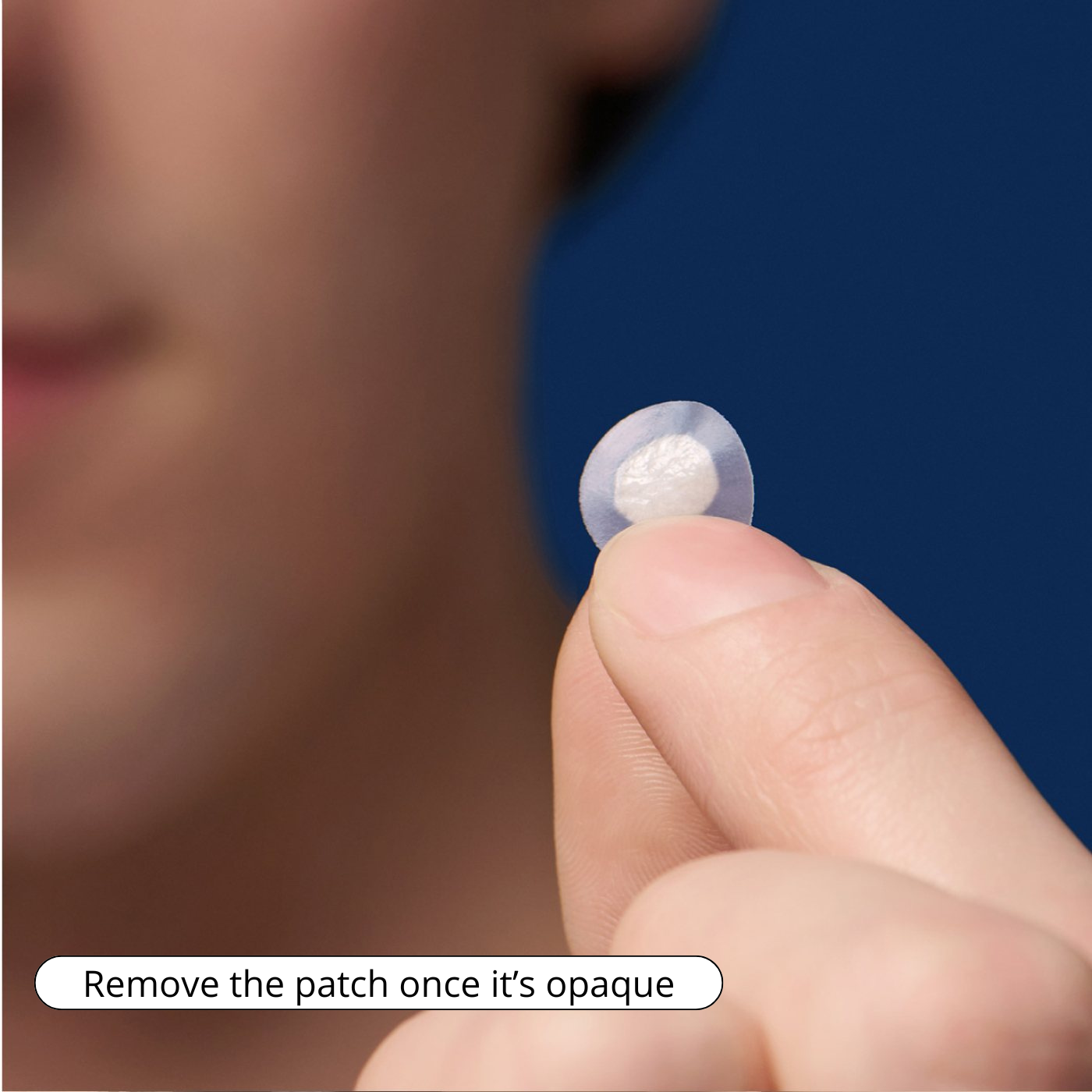 Pimple Patches™ Original patch